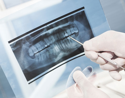 Dental Xrays, Chilliwack